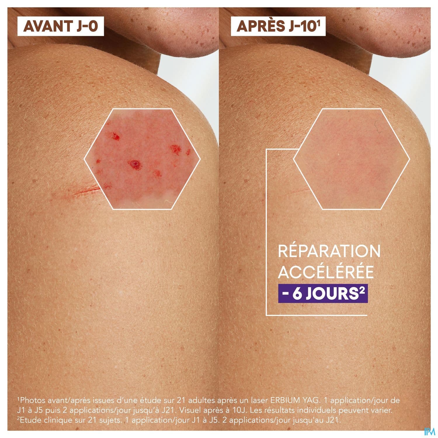 A-DERMA EPITHELIALE ULTRA REP 40ML