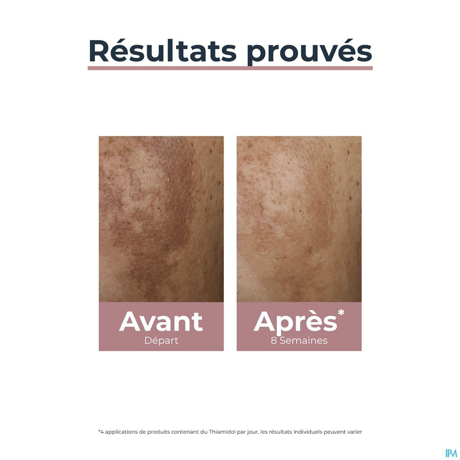 EUCERIN ANTI PIGMENT CORRECTEUR