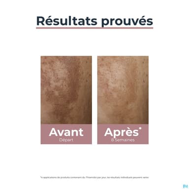 EUCERIN ANTI PIGMENT CORRECTEUR