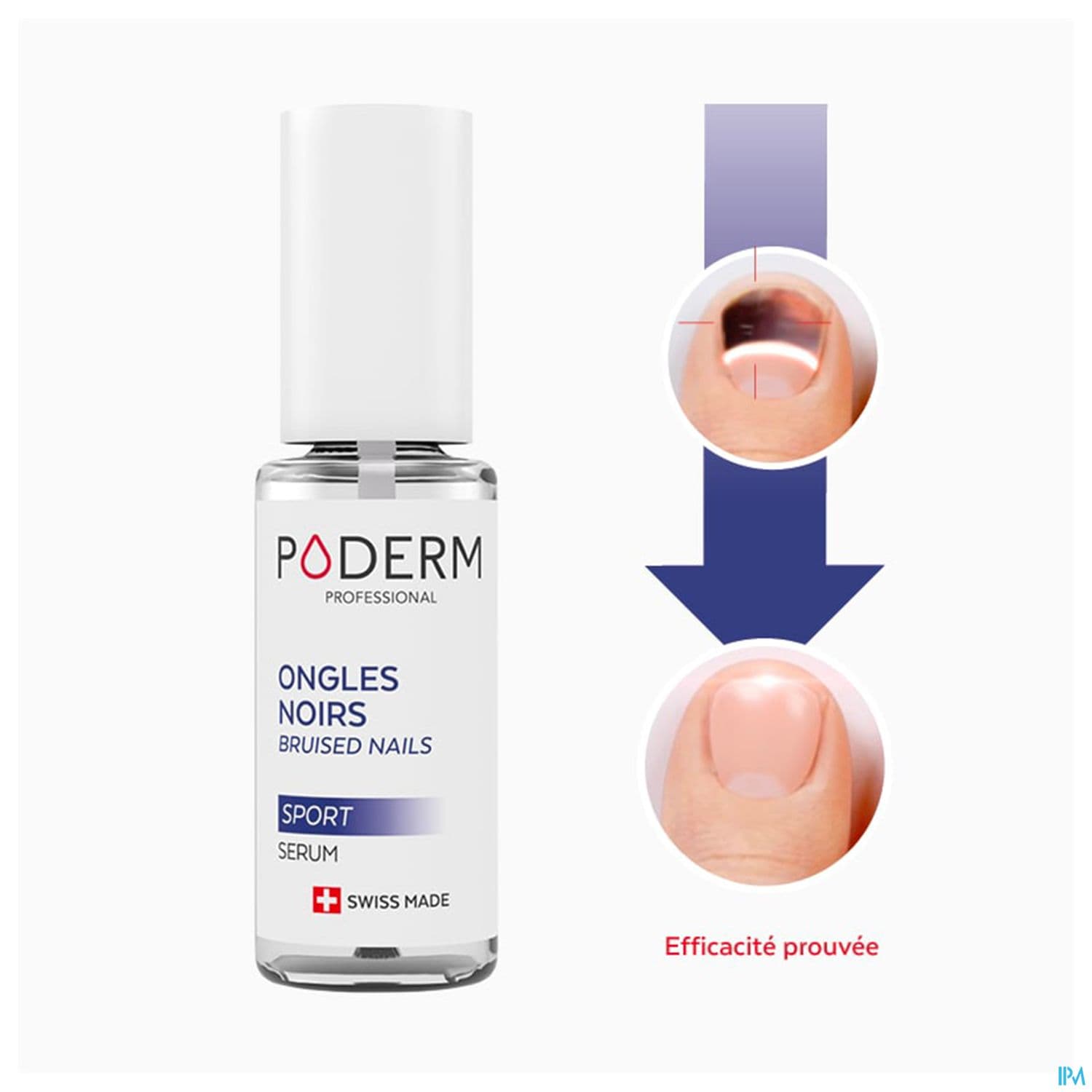 PODERM ONGLE NOIR TRAUMATISE 8ML
