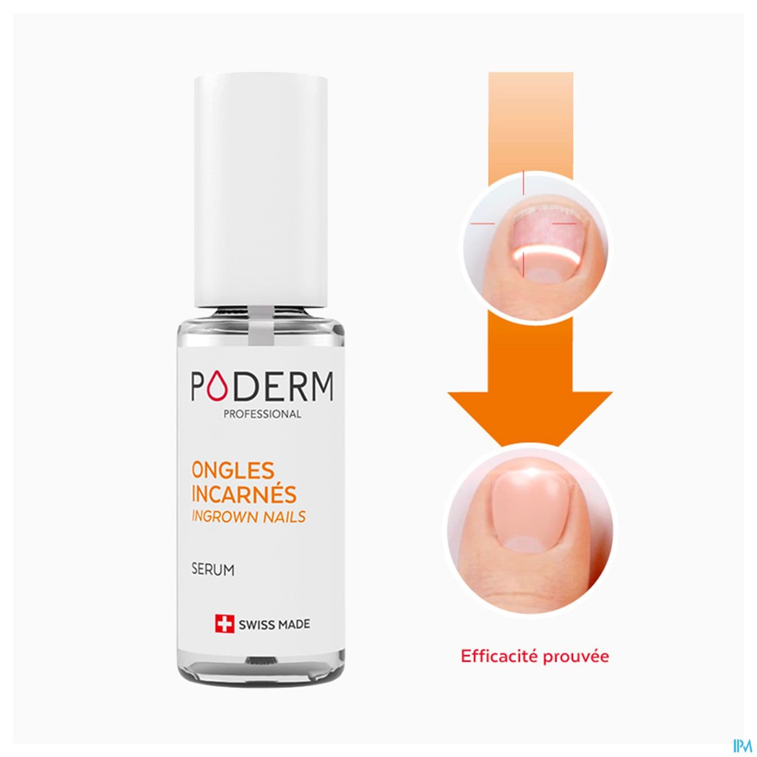 PODERM ONGLE INCARNE APAISANT 8ML