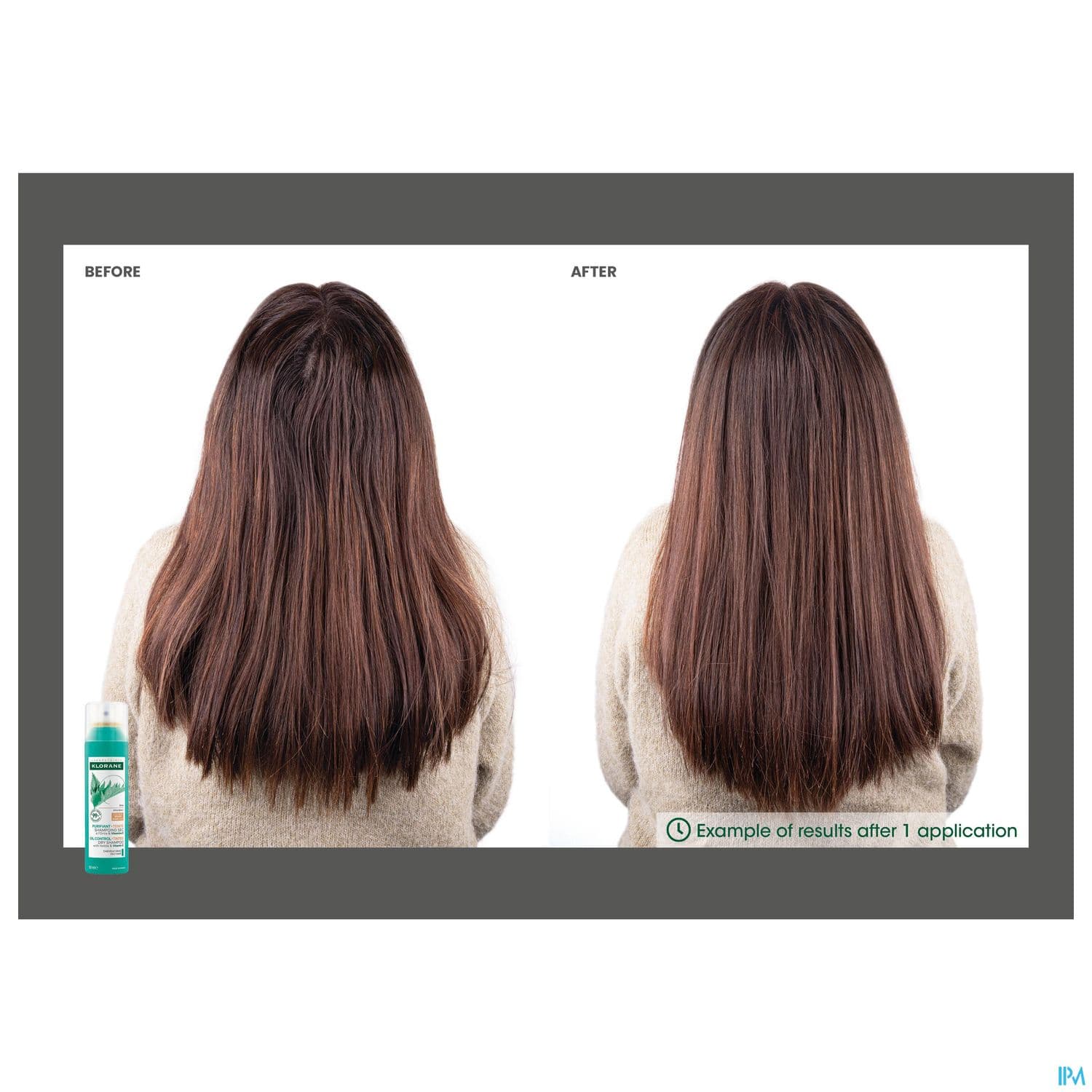 Klorane Shampooing Sec Teinte Ortie + Vitamine E 150ml