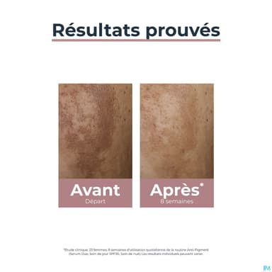 EUCERIN ANTI PIGMENT JOUR 50ML