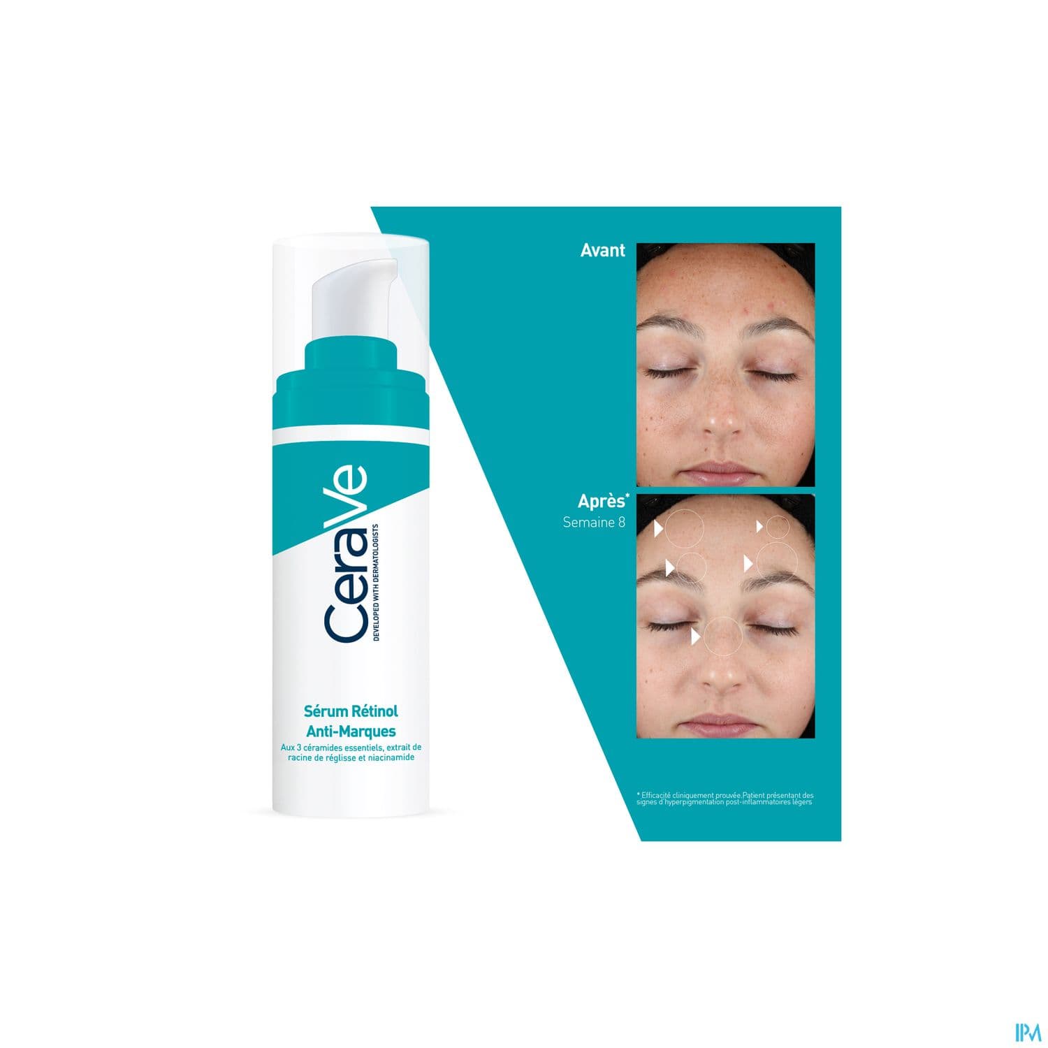 CERAVE SERUM RETINOL A/IMPERF 30ML