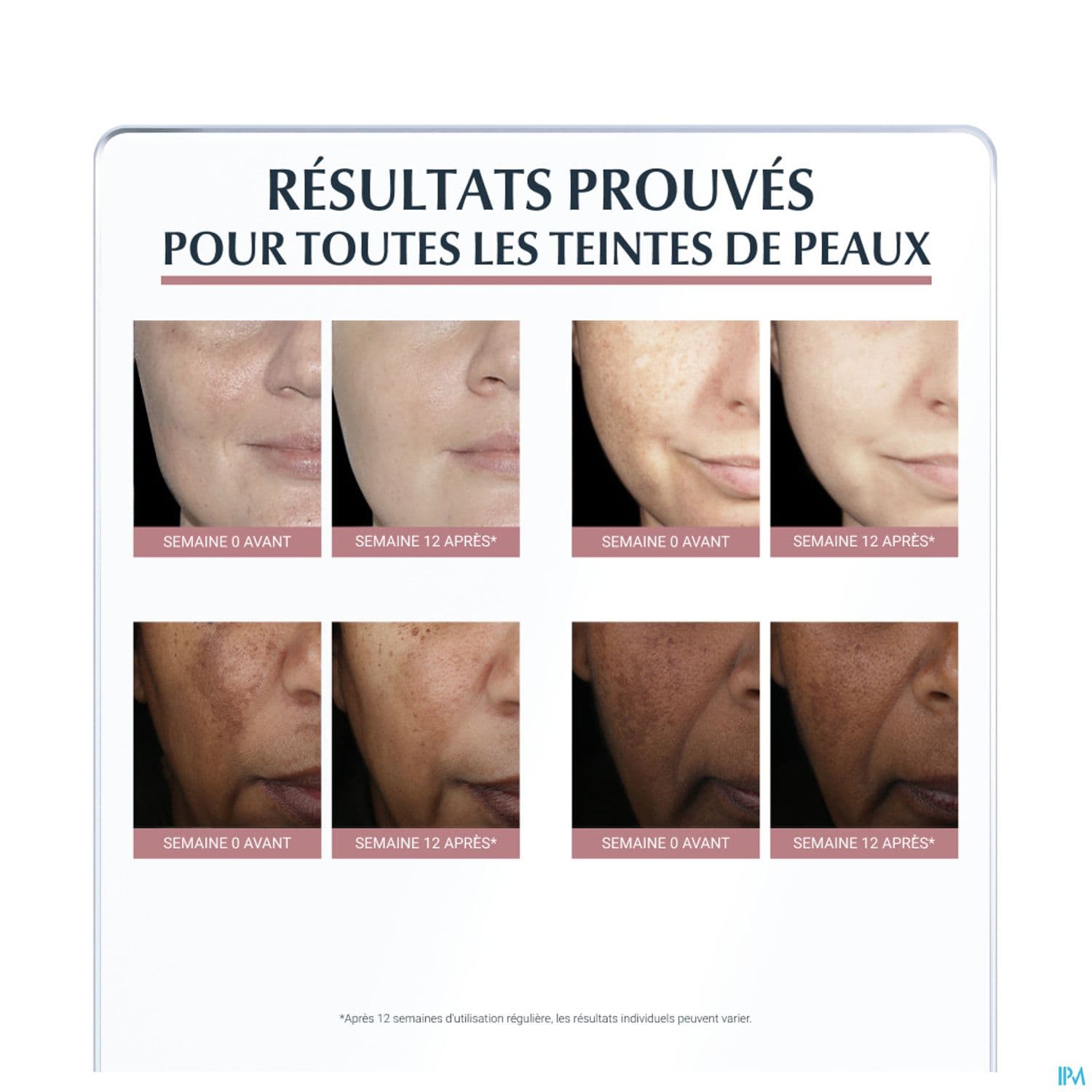 EUCERIN ANTI PIGMENT CORRECTEUR