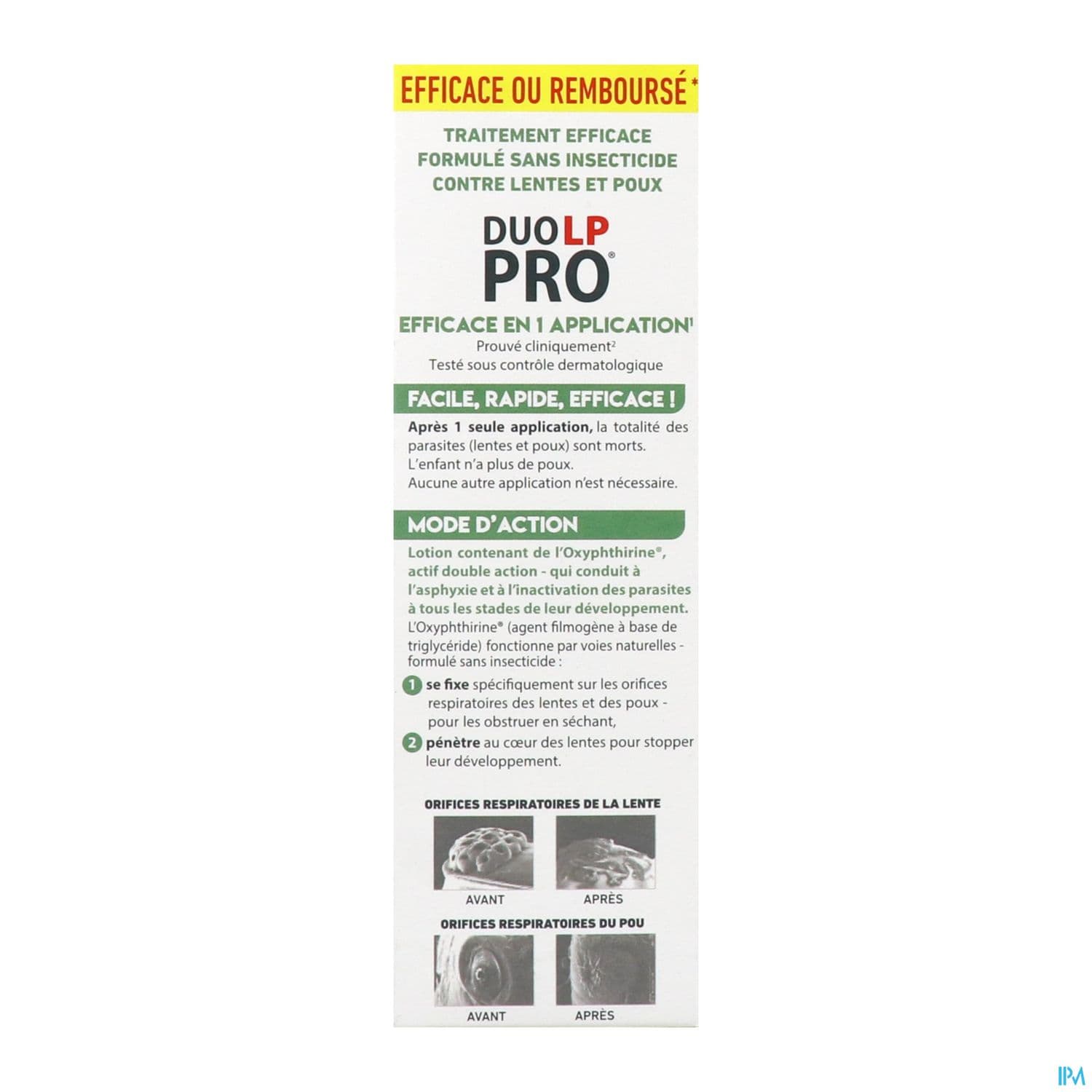 DUO LP-PRO LOTION A/POUX 150ML