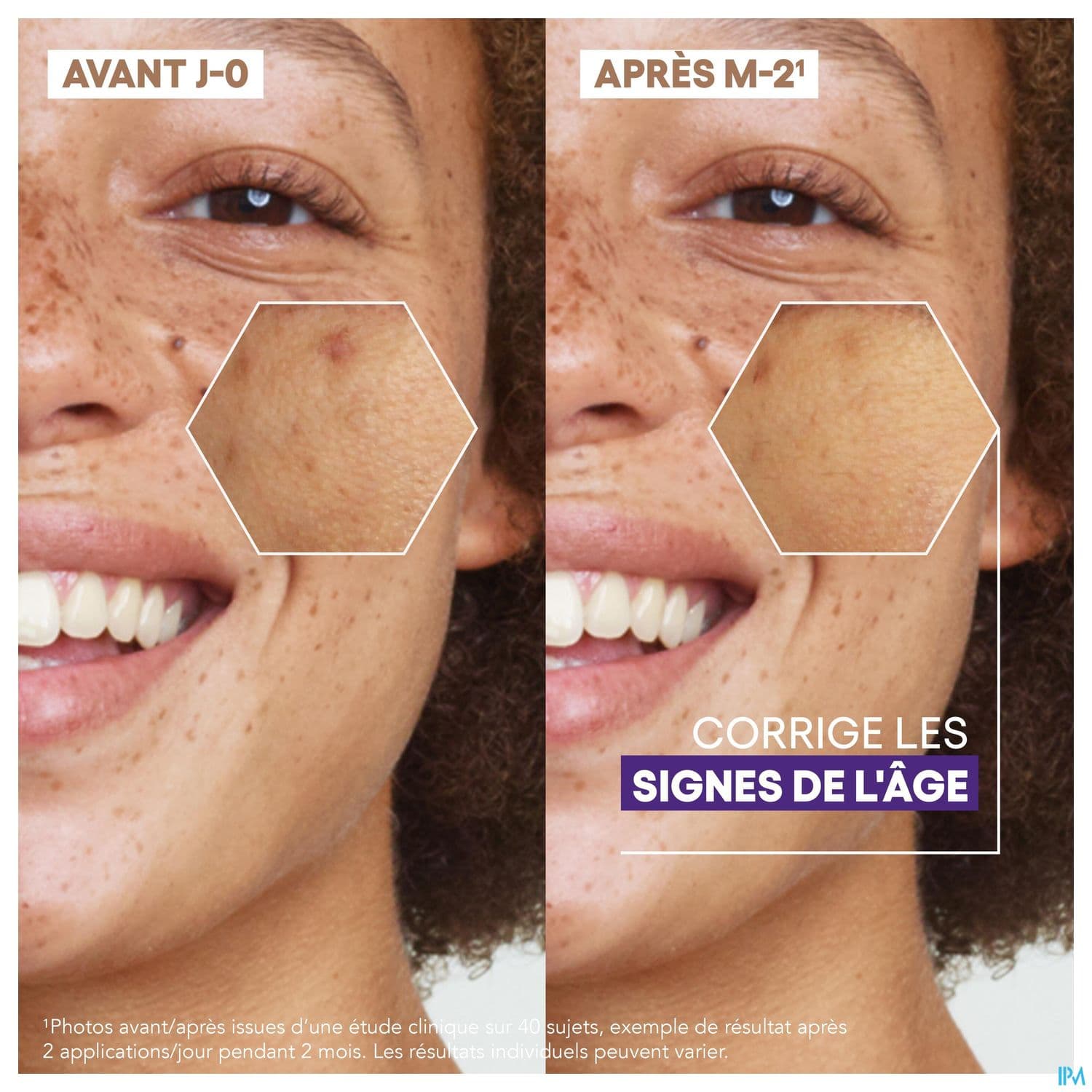 A-DERMA EPITHELIALE SERUM ECLAT 30