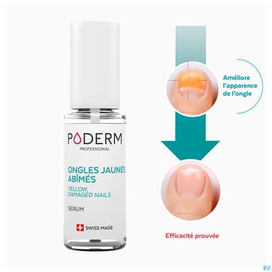 PODERM SERUM MYCOSE ONGLE PURIF