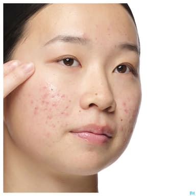 THE ORDINARY SOL ALOE NAG 30ML