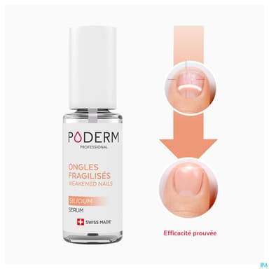 PODERM ONGLE FRAGILISE SILICIUM8ML