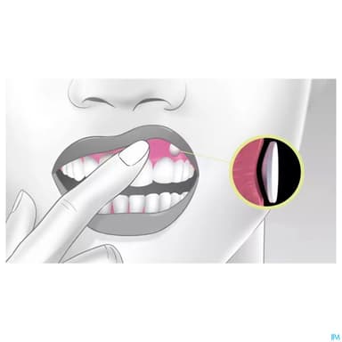 Virpax 50mg Comprime Buccogingival Mucoadhesif 1