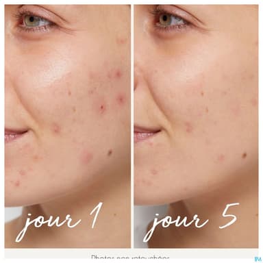 LA ROSEE SERUM PURIFIANT 30ML