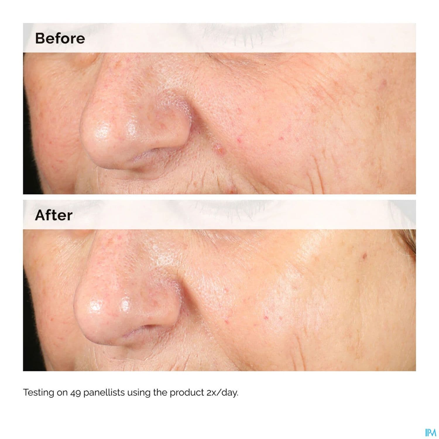 THE ORDINARY ALPHA ARBUTIN+HA.30ML