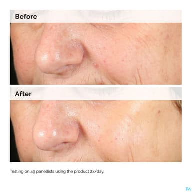 THE ORDINARY ALPHA ARBUTIN+HA.30ML
