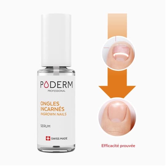 PODERM ONGLE INCARNE APAISANT 8ML — Pharmacie Carnot